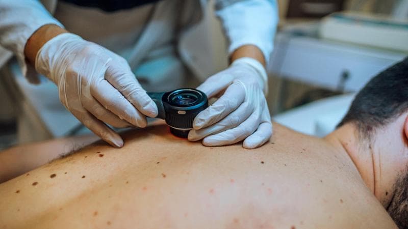 Tatuaggi, le novità introdotte dalla recente normativa. Rischi di melanoma e informazioni utili da conoscere. 1