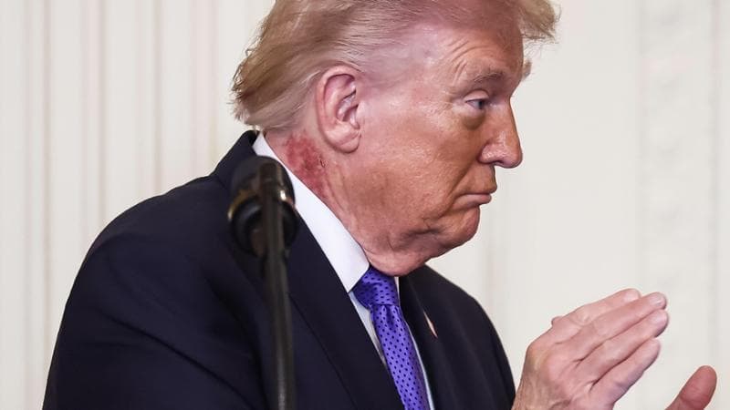 Appare una macchia sul collo di Trump, la Casa Bianca chiarisce: “È causata da una crema per la pelle” 1
