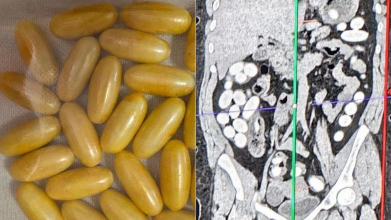 Bolzano supera Milano nel consumo di cocaina e cannabis: l'analisi delle acque reflue evidenzia l'uso di sostanze stupefacenti. 2