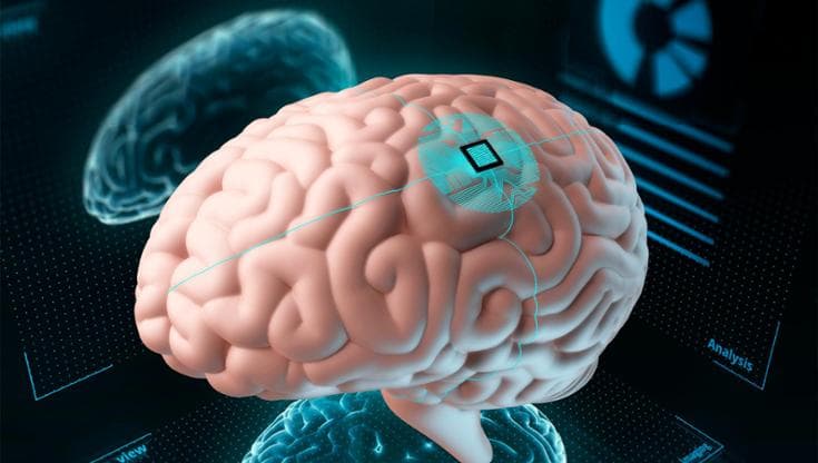 La Cina ha recentemente autorizzato la commercializzazione del primo chip per il cervello, superando così Musk. 2