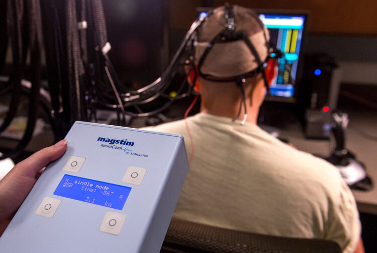 La tDCS potrebbe fermare l'avanzamento dell'Alzheimer. 1