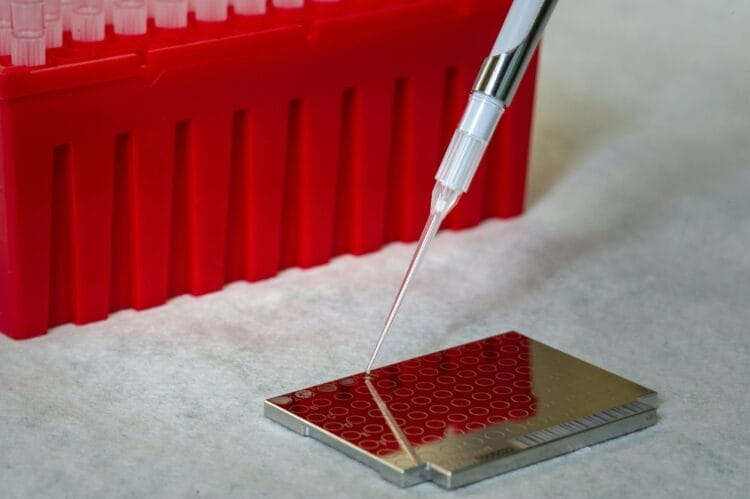 Nuove terapie per la Sindrome di Leigh: prospettive per i pazienti 1