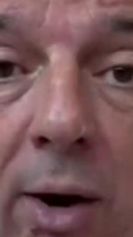 Renzi: “Ho subito l’asportazione di un melanoma cutaneo, ora sono al sicuro. Fate sempre controlli” 3