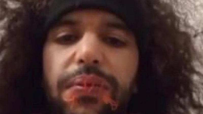 Palermo, calciatore libico detenuto si sutura le labbra. Le motivazioni alla base della sua protesta. 2