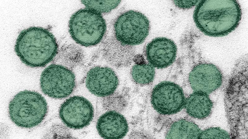 Hantavirus, secondo gli specialisti: “Trasmissione tramite roditori, contagio tra esseri umani raro. Tuttavia, non esiste una terapia” 2