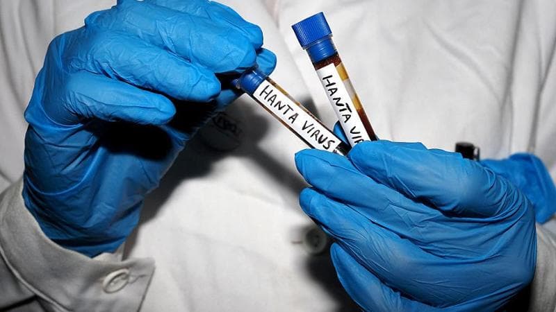 Professore sudafricano isolato a Padova per Hantavirus: nonostante il risultato negativo, non farà ritorno in patria. 2