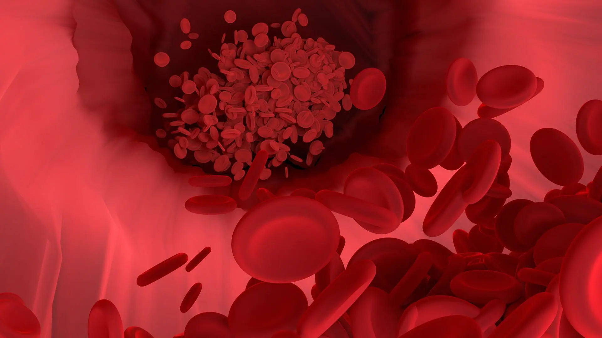 Nanoparticelle di plastica nel sangue coronarico: una nuova ricerca 1