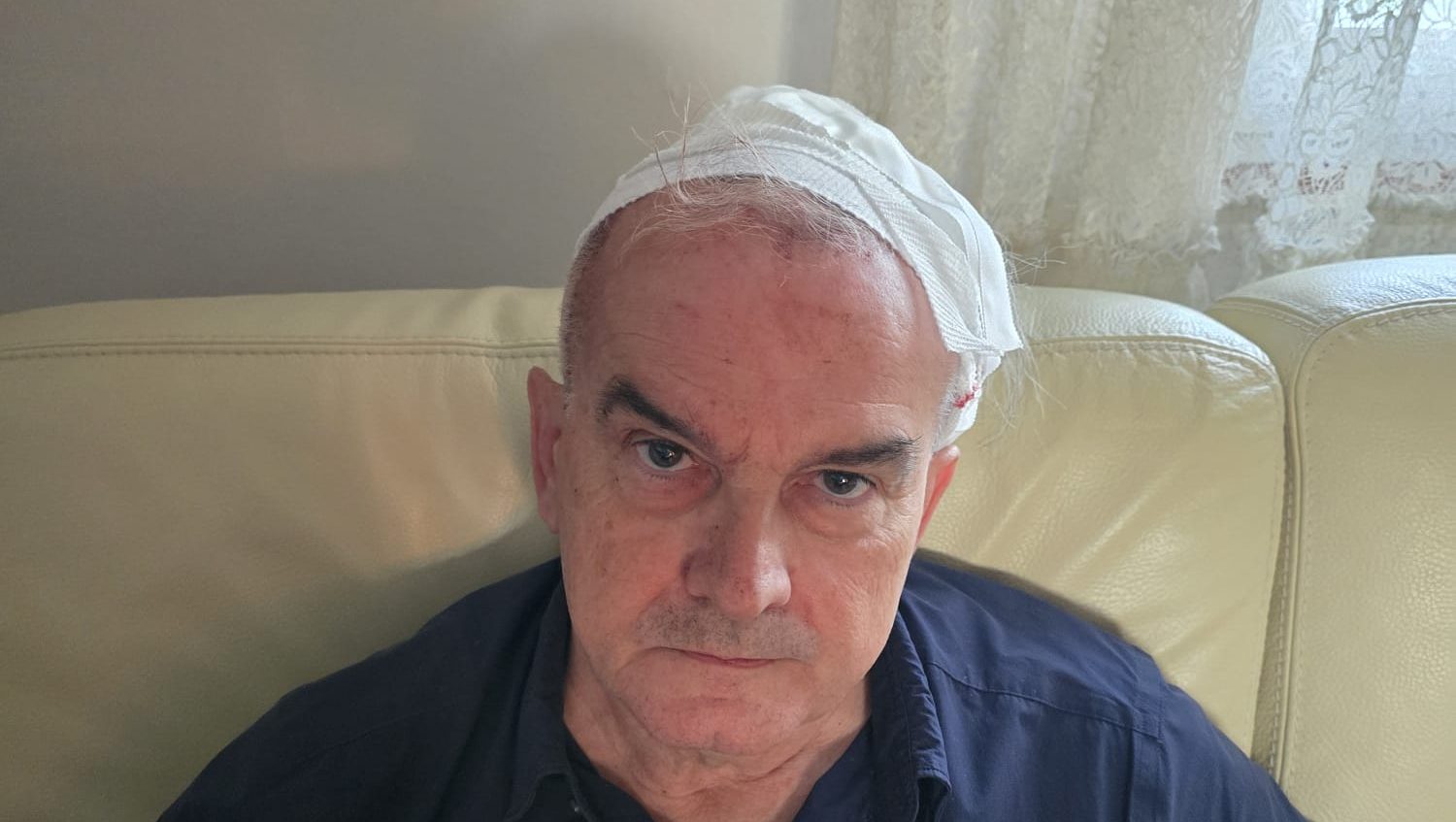 Professore di Unife colpito al capo col piede di porco dai ladri: «Sono stato miracolato» 1